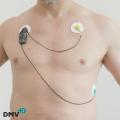 Holter Cardiaco 24h a Domicilio