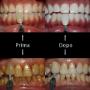 Gallery Professionale