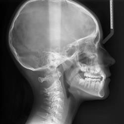 3D Radiologia Treviso