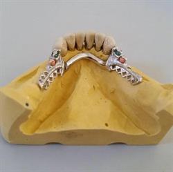 D.M. Dental laboratorio di scheletrica