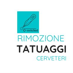 Rimozione Tatuaggi Cerveteri