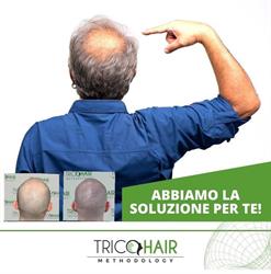 Tricohair Methodology