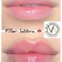 Filler Labbra