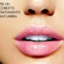 filler labbra Aversa medico estetico caserta