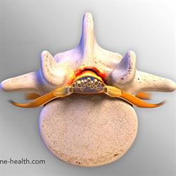 Studio di Fisioterapia e Osteopatia Simone Paesani