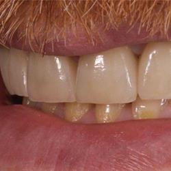 LOGE Dental snc Laboratorio Odontotecnico