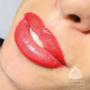 Gallery Professionale