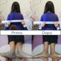 Prima-e-dopo-Allineamento