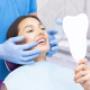 sbiancamento denti