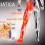 trattamento per la sciatica infiammata