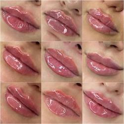 Dottoressa Fanta Natasha - Trattamenti estetici & Filler Labbra