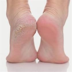 Solo Pedi-Cure di Sturdà Natallia
