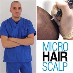 Micro Hair Scalp Tricopigmentazione Sicilia