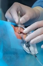operazione specialista oculista