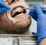 Ricostruzione dentale conservativa a Lecce - Studio Odontoiatrico Stere