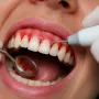 Gengive infiammate e igiene dentale professionale - Studio Odontoiatrico Stere
