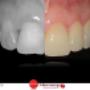 estetica dentale