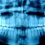 Radiografie