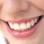 Sorriso Perfetto
