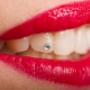 Applicazione Swarovski Centro Dentale Pucci