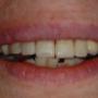 sorriso