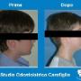 Modifica su Denti dei Bambini