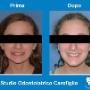Modifica su Denti dei Bambini