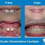 Modifica su Denti dei Bambini