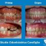 Lavoro su Denti