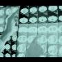 Lastre Crtf Radiologia e Terapia Fisica