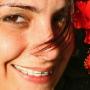 Allineamento Denti Adulto