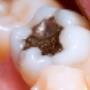 Studio Dentistico Gelmi Dr. Luigi Foto 5