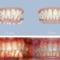 invisalign