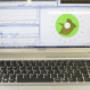ESAME VOCALE MDVP MULTI DIMENTIONAL VOICE PROGRAM