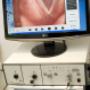 STUDIO ENDOSCOPICO CORDE VOCALI