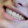 Sorriso sano