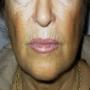 Filler codice a barre prima